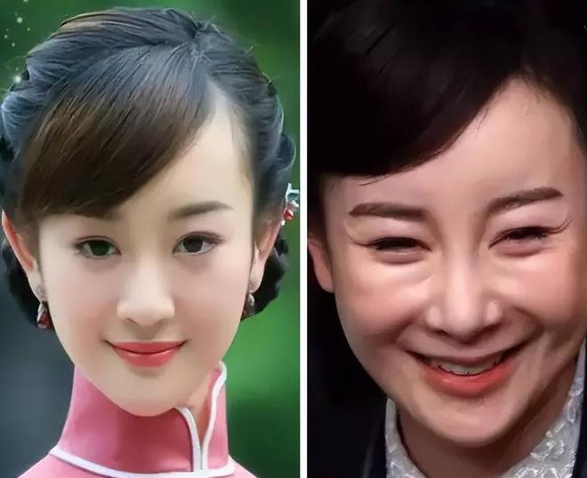出老年斑有人家破人亡毁了脸6位过气明星现状：有人长(图2)